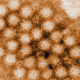 A digitally-colorized, transmission electron microscopic (TEM) image of individual norovirus particles